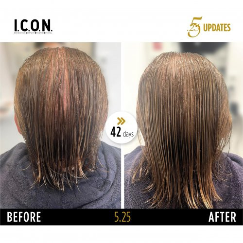 I.C.O.N. 5.25 Hair Growth Replenisher Serumas nuo plaukų slinkimo 100ml