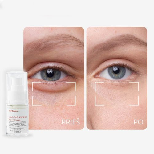 Skinlovers 4’E Anti-Puff & Wrinkle Eye Cream Intensyvus atstatomasis kremas paakių zonai 15ml